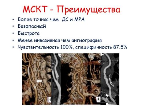 Лечение стеноза ВСА справа