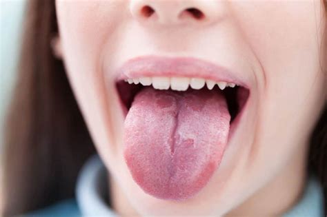 Лечение укуса языка