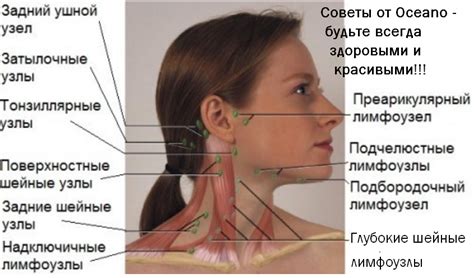 Лимфаденопатия шеи