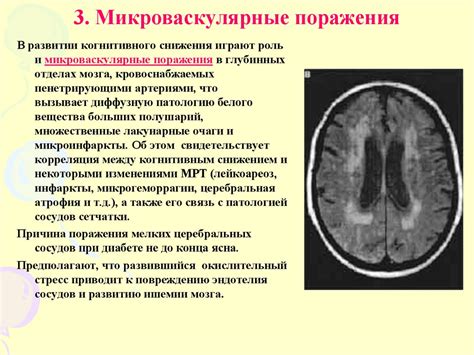 Локальное расширение субарахноидального пространства