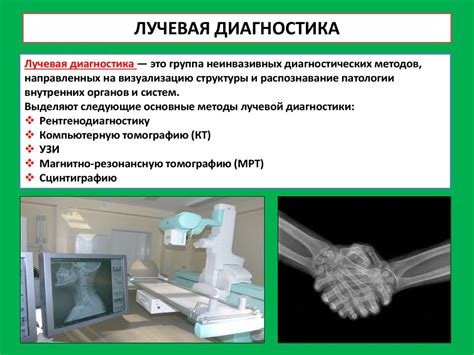 Лучевые методы диагностики пиелоэктазии