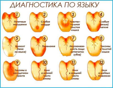 Медицинские методы лечения трескающегося языка