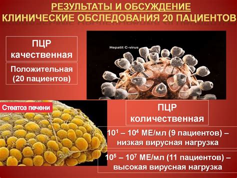 Методы диагностики гепатита C