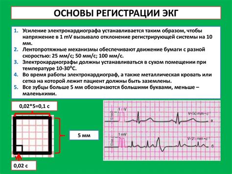 Методы диагностики и выявления НДЖП на ЭКГ