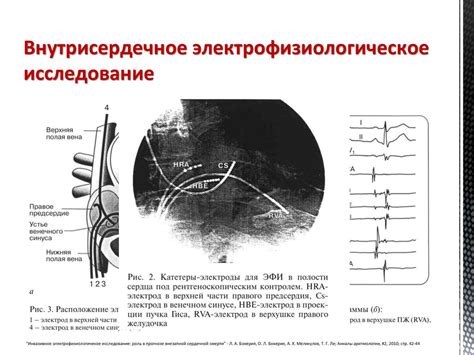 Методы диагностики и лечения нарушения сердечного ритма