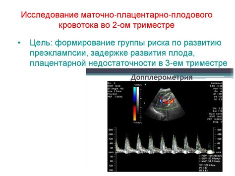 Методы диагностики нарушения маточно-плодового кровотока