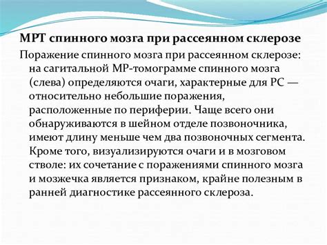 Методы диагностики рассеянного склероза: обзор и сравнение