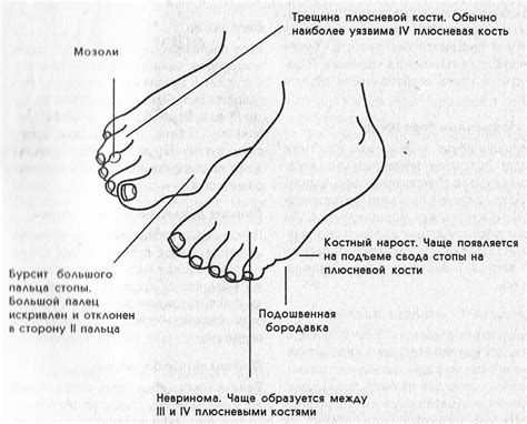 Методы лечения и предотвращение возникновения немощности левой ноги