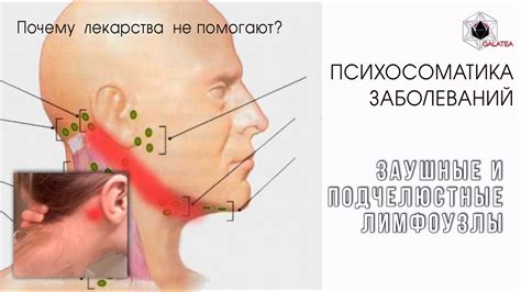 Методы лечения и профилактика болей в лимфоузлах за ушами