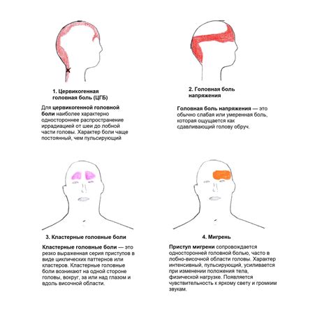 Методы облегчения боли и лечение резкой головной боли