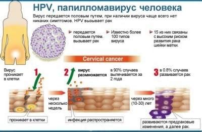 Методы передачи ВПЧ