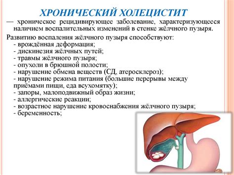 Методы профилактики обострения хронического холецистита