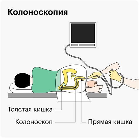 Методы эндоскопического обследования