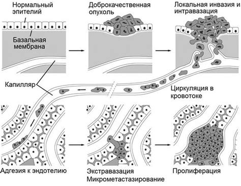 Механизмы развития лимфососудистой инвазии