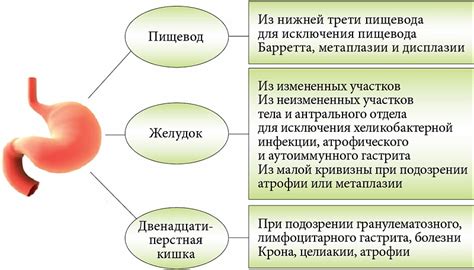 Механизм действия антисекреторных препаратов на кислотообразующие клетки слизистой оболочки желудка