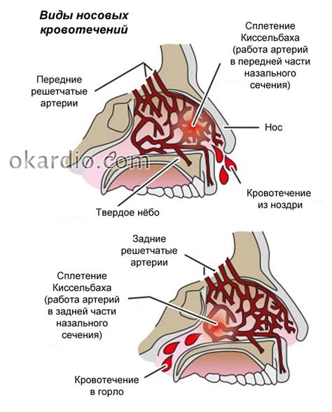 Механические повреждения носа и головы