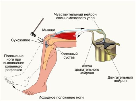 Молоток - основной инструмент для проверки коленного рефлекса