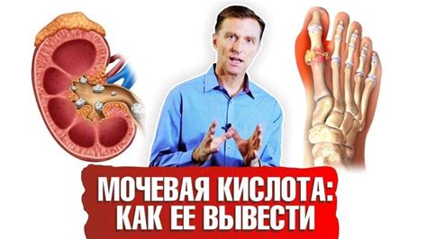 Мочевая кислота и ее значение