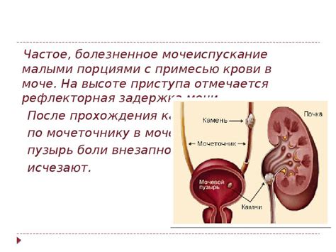 Мочеиспускание с примесью крови: что это означает и стоит ли волноваться?