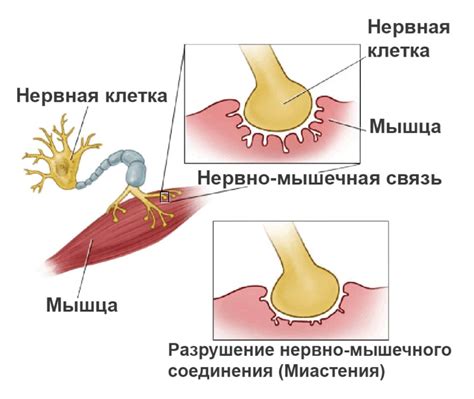 Мышечная слабость или деформация