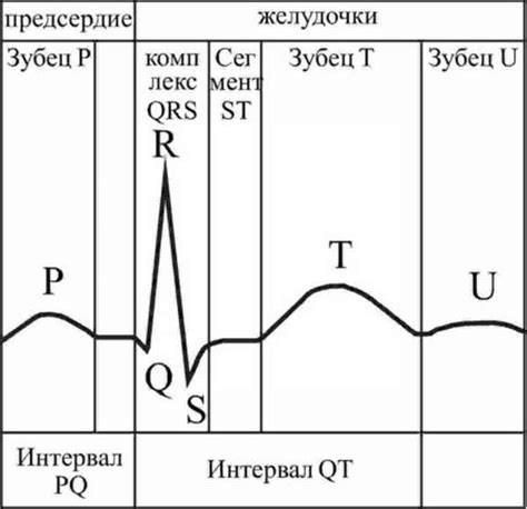 НДЖП на ЭКГ: общие сведения