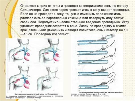 Назначение точечного введения иглы в медицине