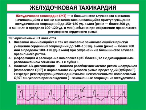 Нарушение сердечного ритма