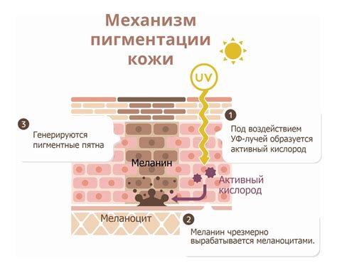 Нарушения пигментации кожи