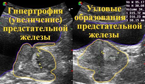 Натощак: роль этого состояния перед УЗИ