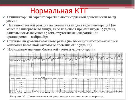 Начальное нарушение плода при КТГ