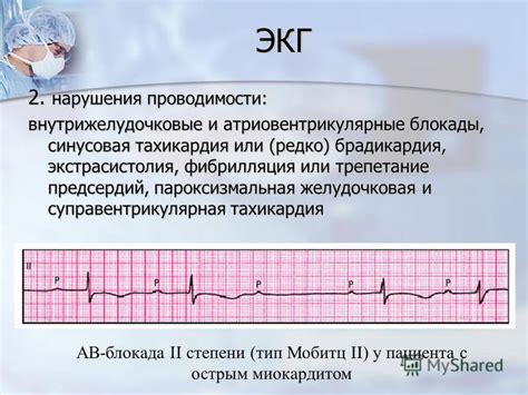 На что обратить внимание при нарушении внутрижелудочковой проводимости сердца у ребенка?