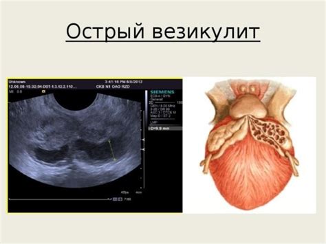 Невоспалительные причины болей в яичках