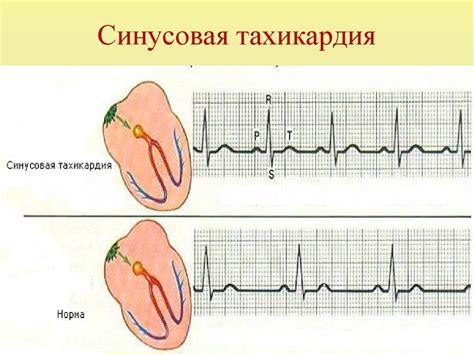 Невыполнение критерия: тахикардия или брадикардия