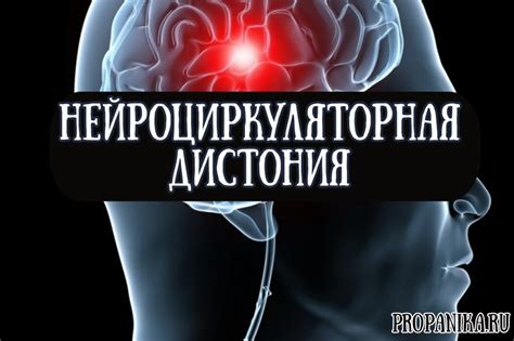 Нейроциркуляторная дистония по гипотоническому типу: симптомы