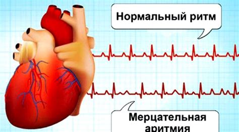 Некроз сердца: все о причинах и последствиях