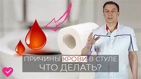 Необходимо ли пройти обследование при наличии крови в кале?