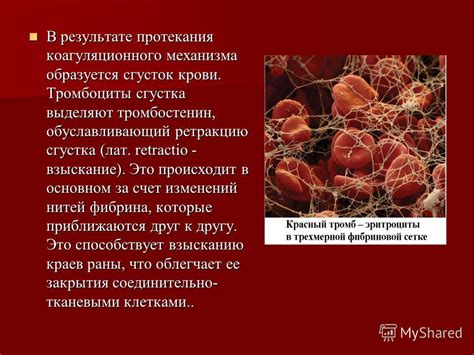 Неожиданный символизм: что означает образ сгустка крови в носу в сфере сновидений