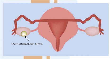 Неоперабельная киста: понятие и описание