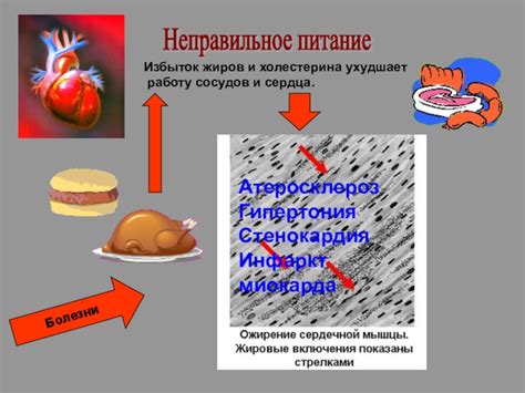 Неправильное питание: избыток жиров и сахара - враги здоровья сердца