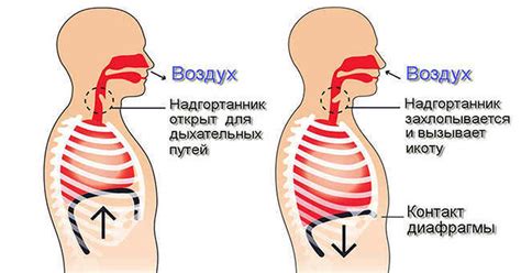 Непроходимая икота: что это такое?