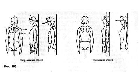 Неравномерная осанка