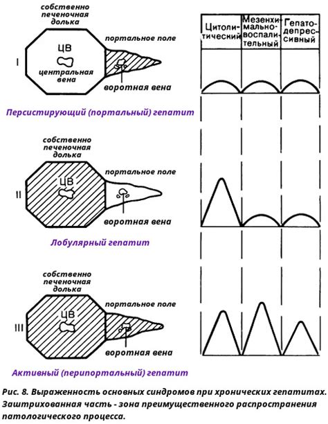 Неспецифический реактивный гепатит