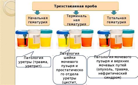 Нестандартные причины сгустков