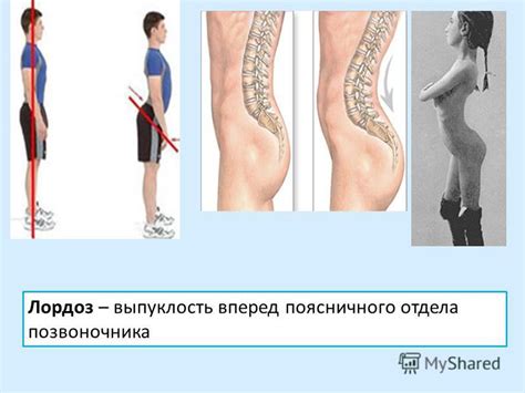 Неудобное положение при сидении и ходьбе