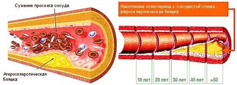 Низкий тромбокрит: физиологические факторы