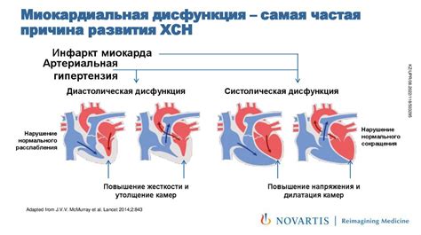 Новые методы оперативного лечения сердечной недостаточности