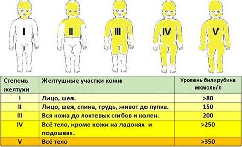 Нормальные значения билирубина у новорожденных