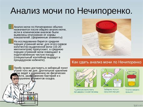 Нормы показателей анализа мочи по методу Нечипоренко для мужчин