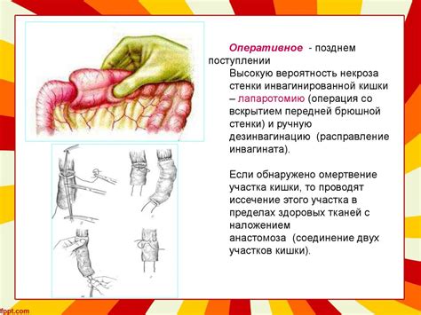 Общие симптомы расширения петель кишечника у детей