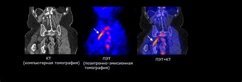 Около РФП в онкологии: основные принципы и применение